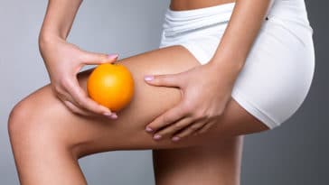 combattere la cellulite