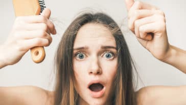 perdita di capelli